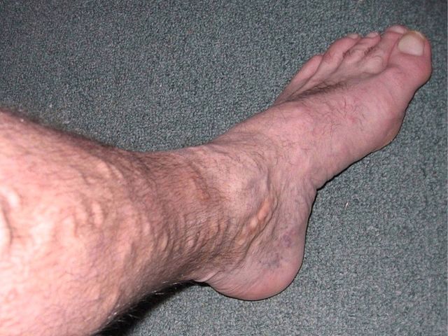 640px Leg Before 1 1