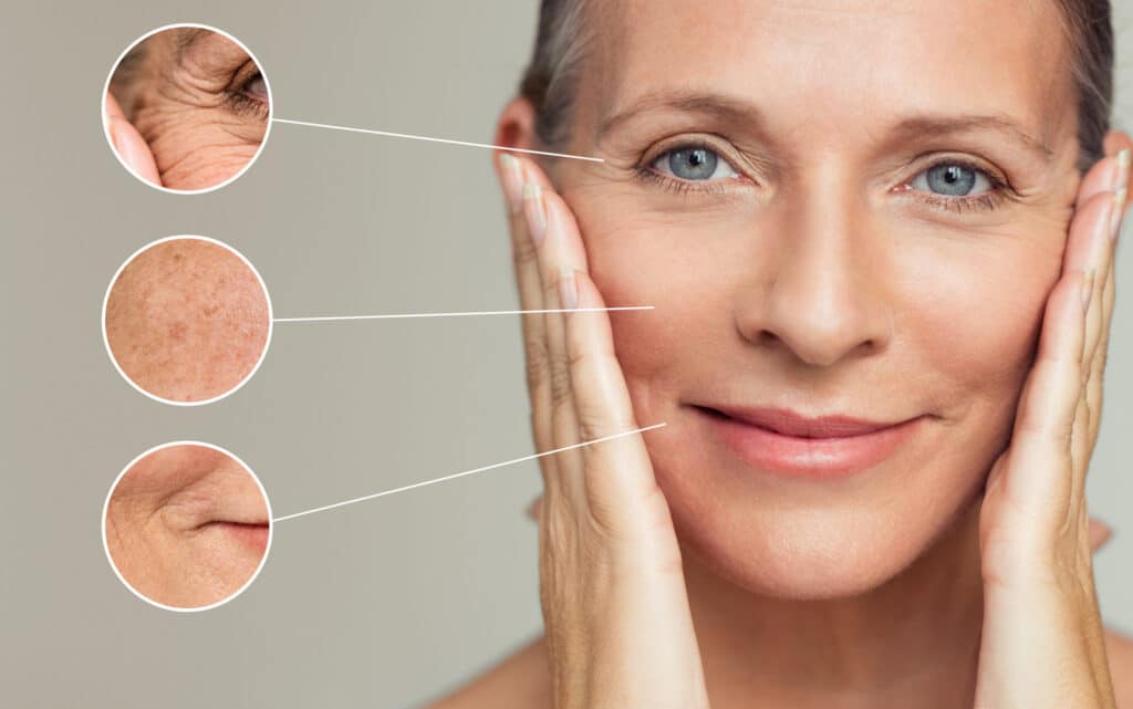 Wrinkles and skin imperfection