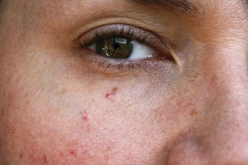 Close-up of a Woman's eye