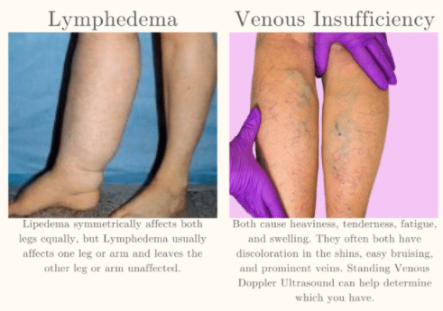 Veins Infographic