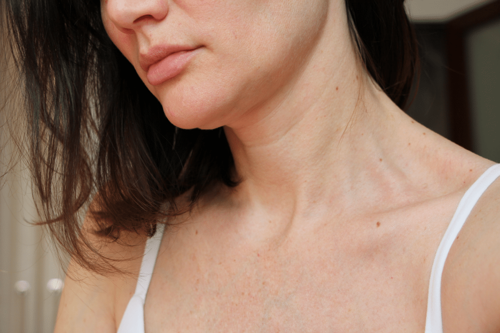 Chest Veins Treatment St Louis 1024x683