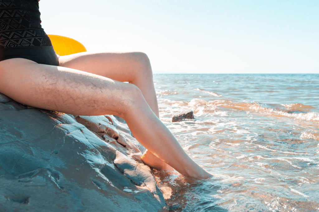 Healthy Veins 1024x683