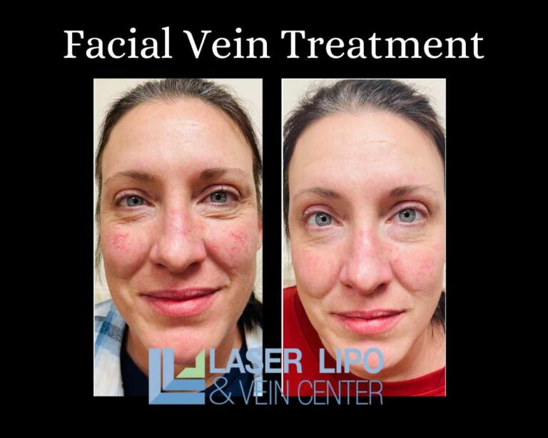 Laser Light Therapy Before and After St Louis Dr Wright 2 768x614 (1)