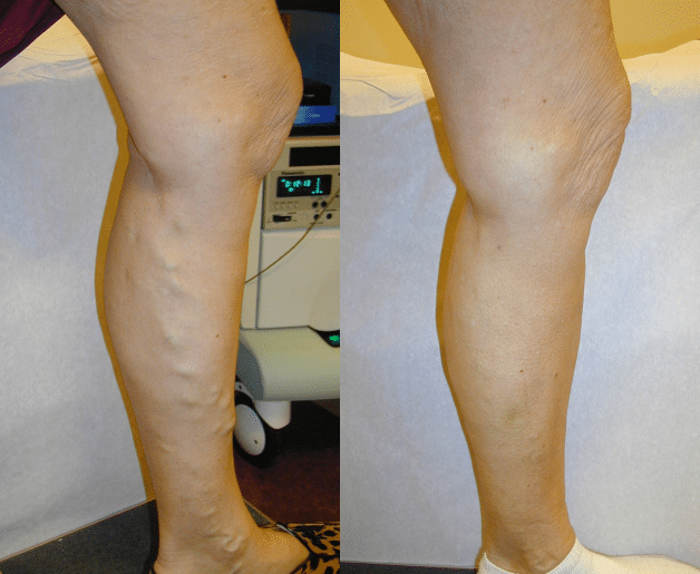 Leg 2 1 week