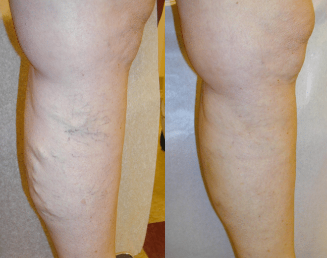 Leg 6 1 week