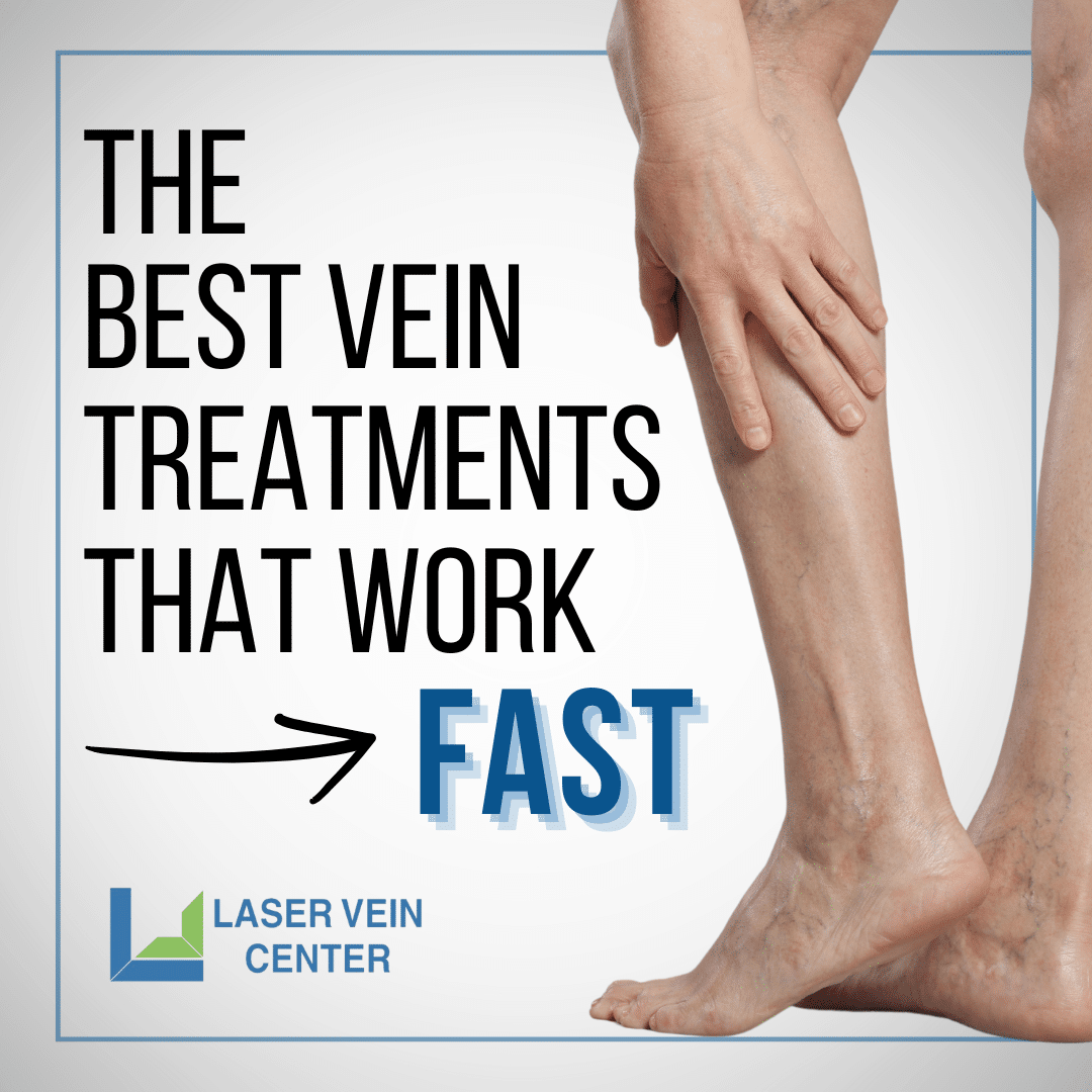 The best vein treatments that work fast