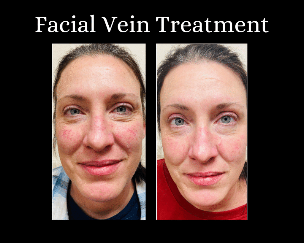 Laser Light Therapy Before and After St Louis Dr Wright