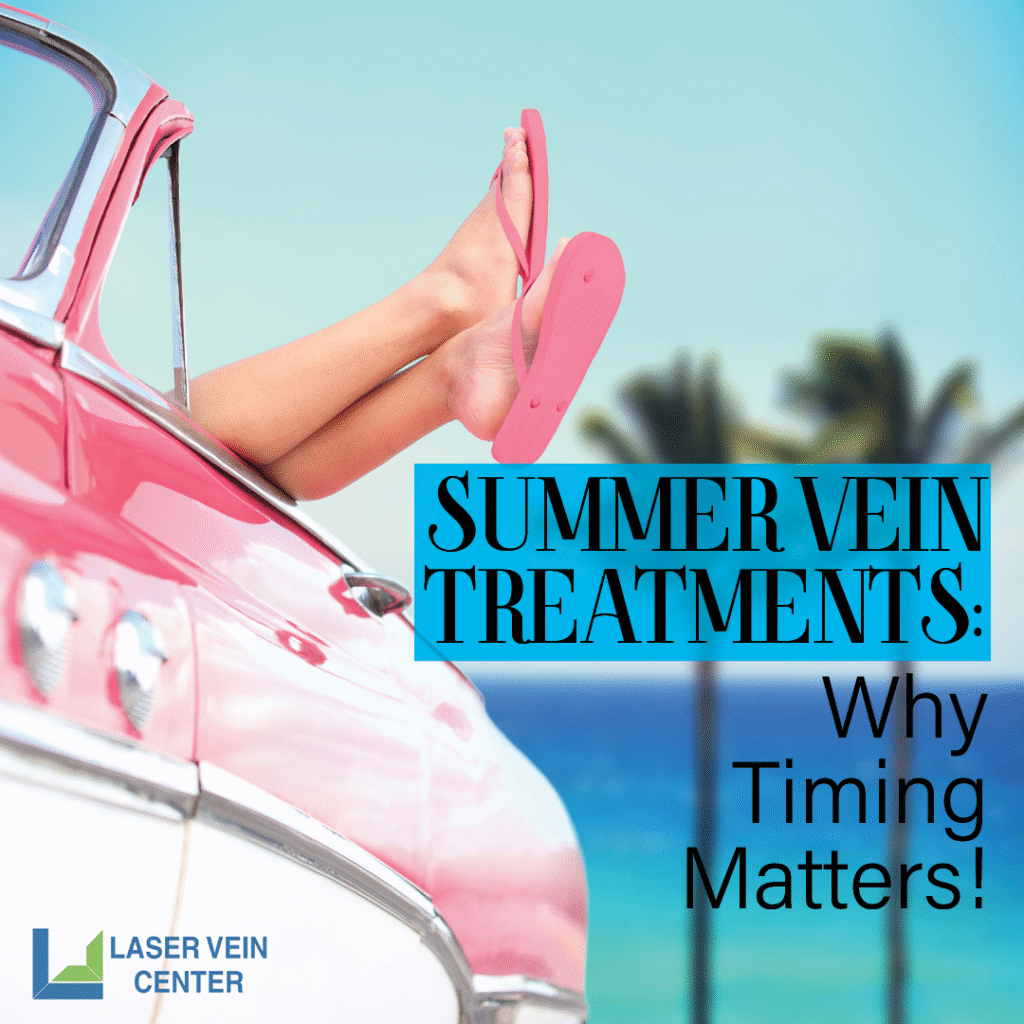 Summer Vein Treatments: Why Timing Matters