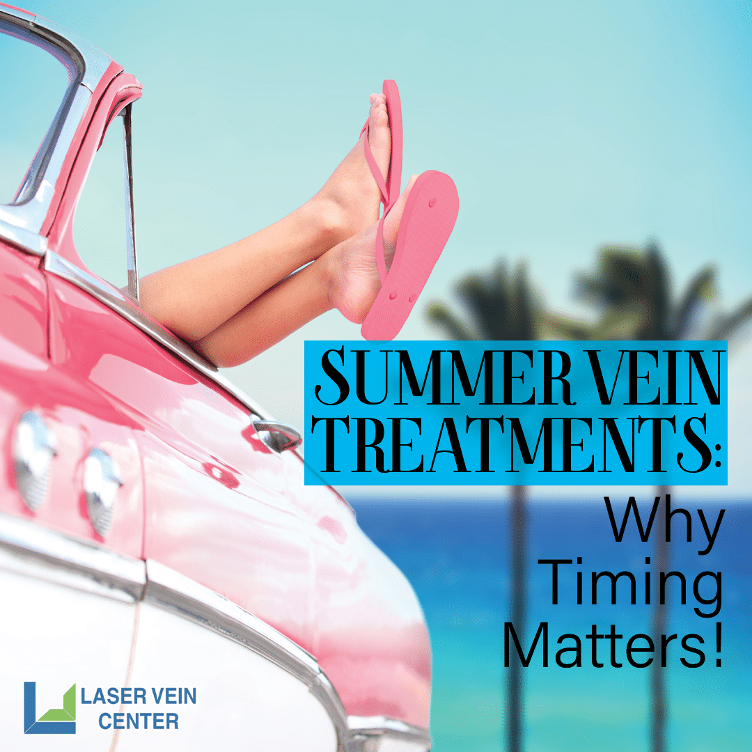 Summer Vein Treatments: Why Timing Matters